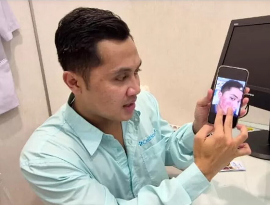 Dafit Kusnadi, Brand Manager dari CellScience menunjukkan foto wajahnya saat mengalami jerawat parah dan kini wajahnya sehat berkat perawatan yang tepat. (Foto: Urbanvibes/R Indriani)