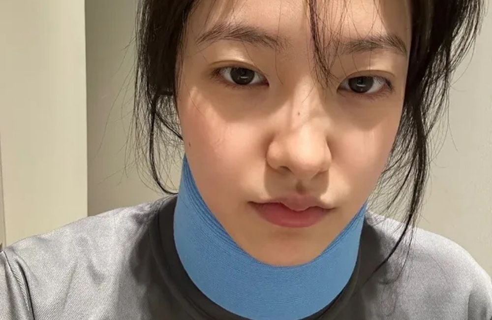 Yeri Red Velvet Cedera Saat Pilates, Tetap Bercanda di Tengah Proses Pemulihan