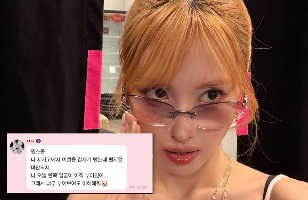 Bikin Kaget! Momo TWICE Tiba-Tiba Cabut Gigi di Tengah Tur