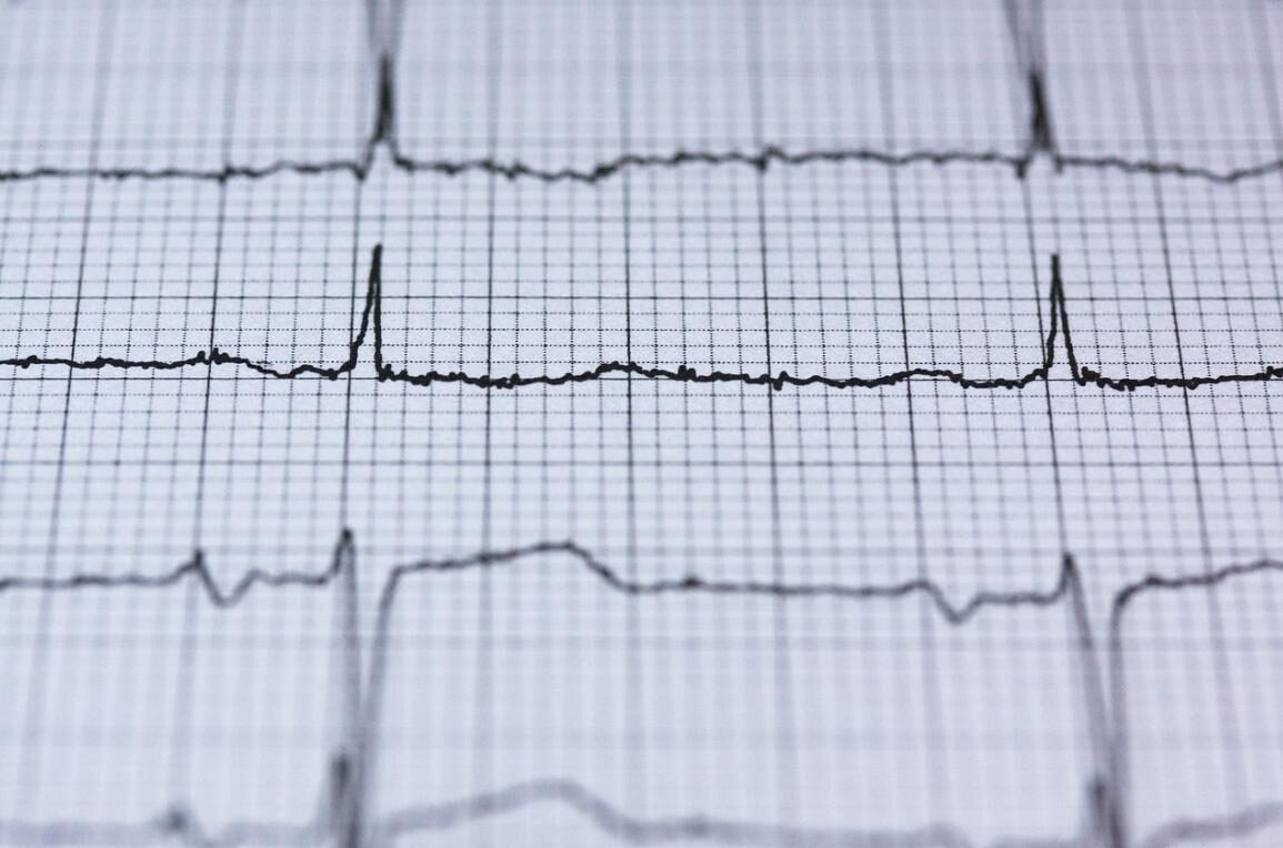 Tak Perlu ke Kota Besar, Kini Warga Kendal Bisa Cek Jantung Lewat Layanan EKG