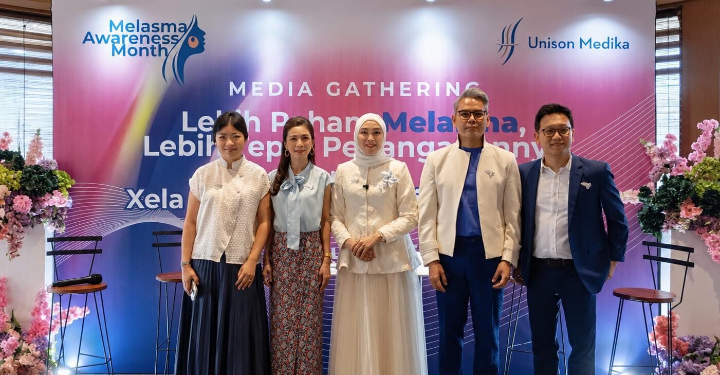 Melasma Tak Sekadar Flek Biasa, Kenali Penyebab dan Cara Penanganannya