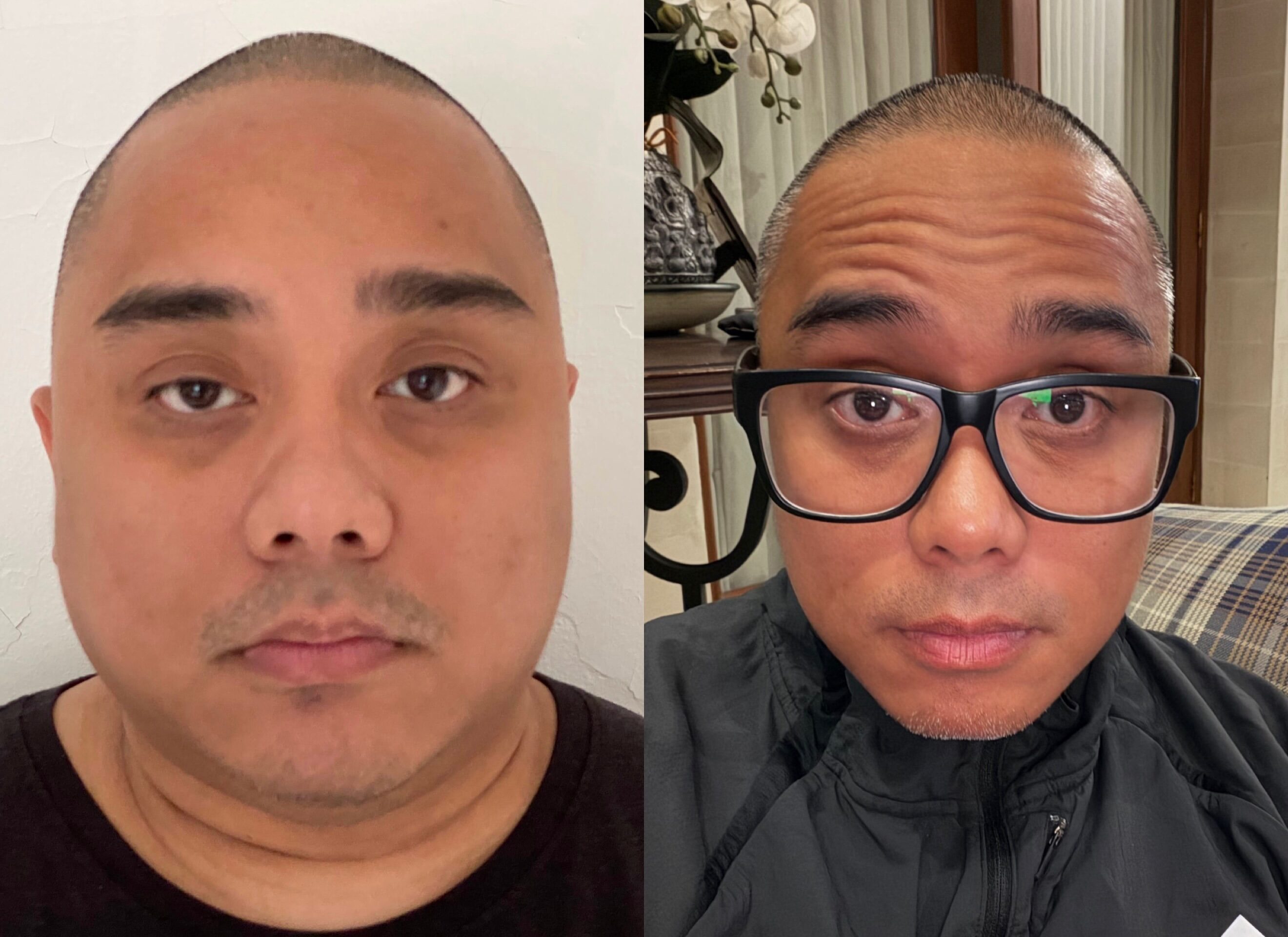 Foto 2020 VS 2026 SAYKOJI Bikin Salfok: Turun Puluhan Kilo, Tapi yang Berubah Bukan Cuma Muka!